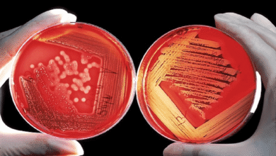 Inilah Perbedaan Monera dan Protista Beserta Penjelasannya