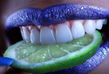 7 Tips Memutihkan Gigi Kuning Secara Alami, Dijamin Ampuh!